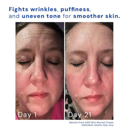 Klear® Cream - A313 Skin Revival Cream